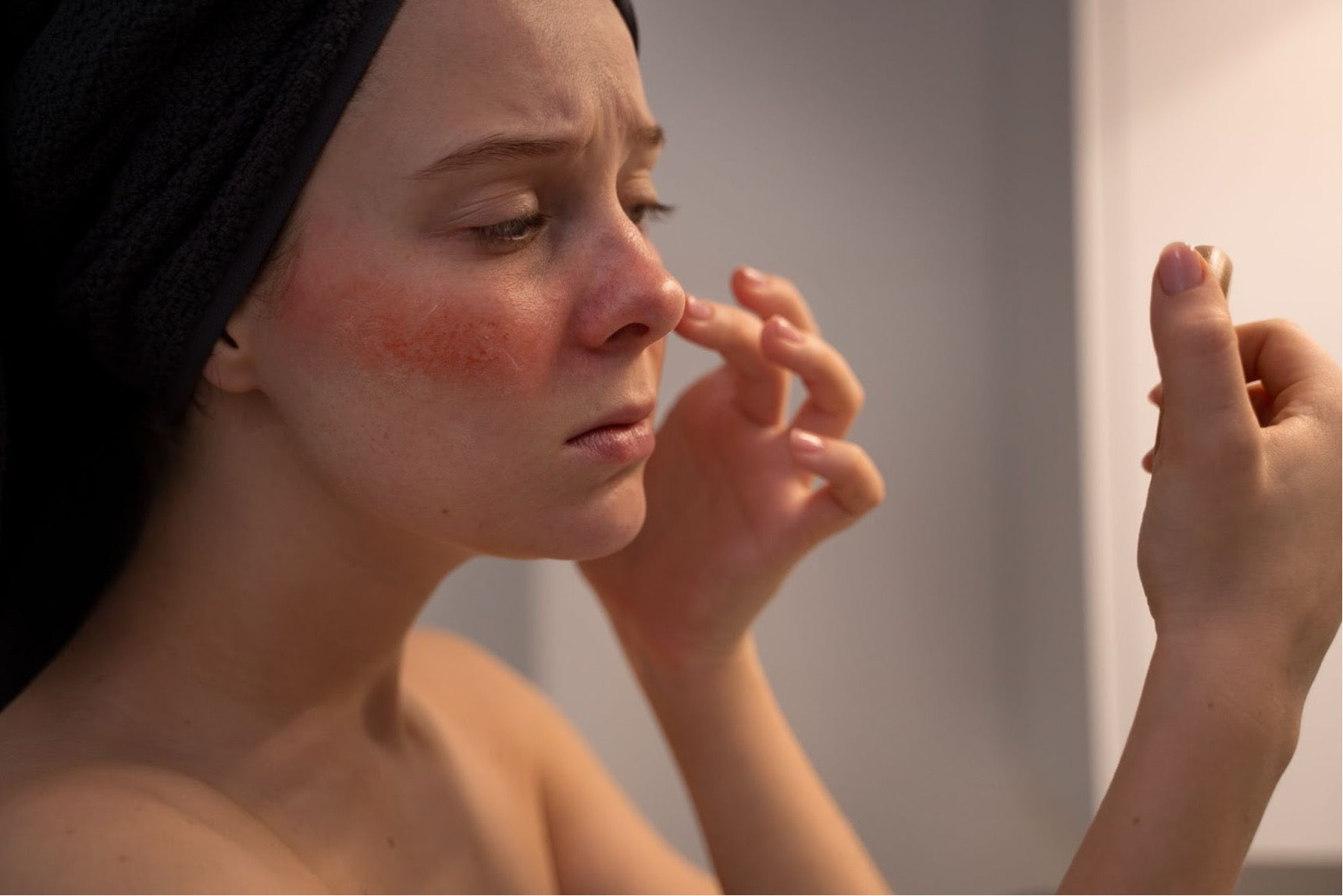 Is Shilajit Good For Seborrheic Dermatitis?