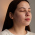 Is Shilajit Good for Acne Scars?