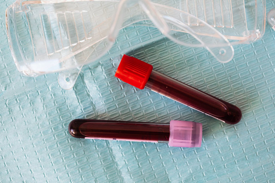 Two blood sample vials on a medical tray, one with a red cap and the other with a purple cap.
