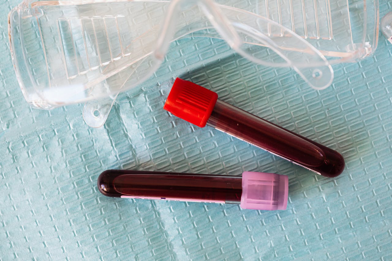 Two blood sample vials on a medical tray, one with a red cap and the other with a purple cap.